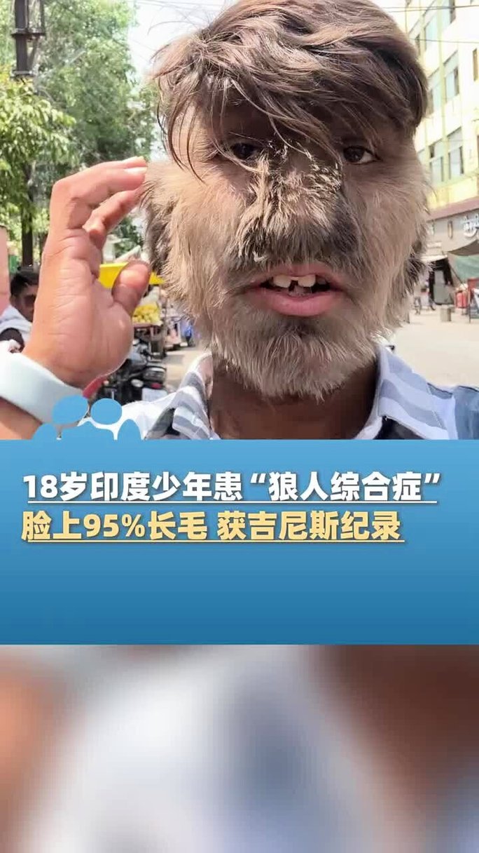 手掌偏黄的是什么原因女性的相关介绍